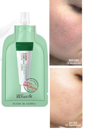 Acne And Blemish Control Cream TYC6GC5KCN168673864936221 - BEAUSTA