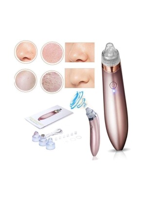 Beautiful Rechargeable 5-Stage Professional Vacuum Blackhead Pimple and Acne Removal Device XN-8030 - Nüans