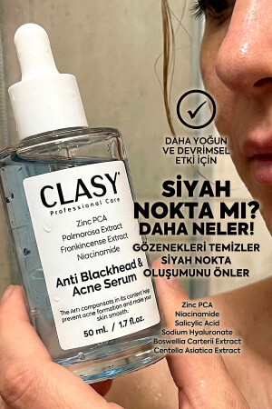 Blackhead and Anti-Prevention Serum - Niacinamide and Zinc - Clasy Care