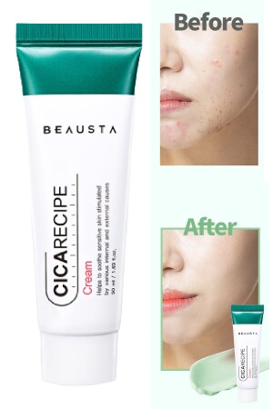 Cica Anti-Akne-Feuchtigkeitscreme, die die Barrierereparatur unterstützt. Cica Repair Cream 50 ml TYCWYJPSTN168673901021625 - BEAUSTA