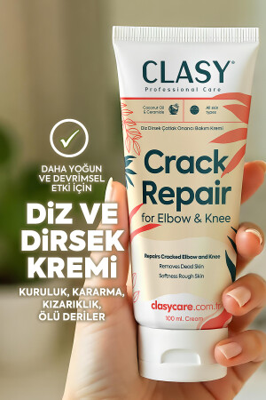 Elbow, Knee and Hand Care Cream - For Cracked, Dry, Darkened and Rough Skin - Clasy Care