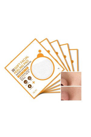Face Peeling 5 pack 1518136 - Mjcare