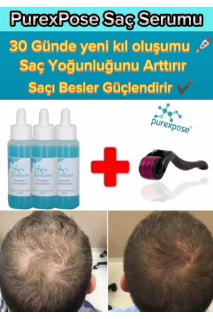 Hair Care Helping Hair Regrowth Repairing Lengthening Nourishing Serum 3 in 1 Dermaroller 9145455876745 - Purexpose