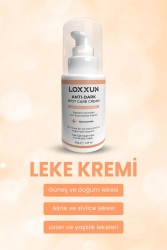 Leke Kremi 50gr L0001 - LOXXUN
