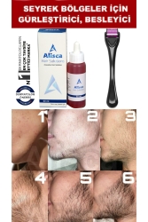 سيروم MNZ-Beard - يساعد على تشكيل الشارب - تساعد على تشكيل الحاجب - تساعد على تحسين الحاجب - Alisca
