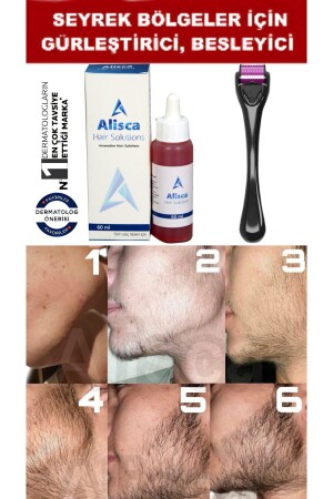 سيروم MNZ-Beard - يساعد على تشكيل الشارب - تساعد على تشكيل الحاجب - تساعد على تحسين الحاجب - Alisca