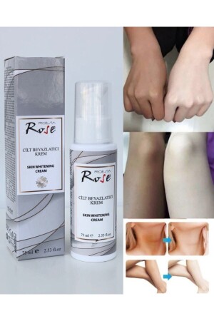 Rose Cilt Beyazlatıcı Krem 75 Ml - Genel Markalar