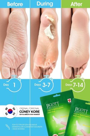Sock Type Peel-Off Foot Peeling Mask - Miracle Foot Peeling Pack - Jigott
