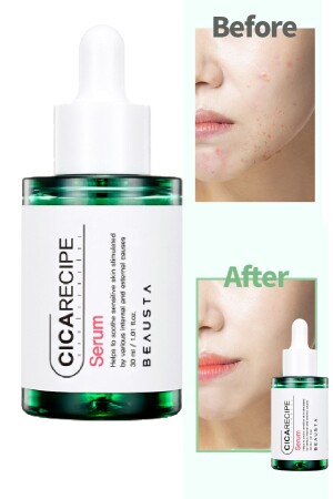 Soothing Anti-Acne Serum Containing Cica Centella for Sensitive Skin TYC6S5XHLN168673904909441 - BEAUSTA