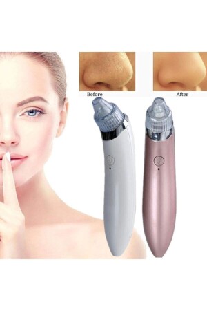 Vacuum Blackhead Acne Removal Device Find Back st-vkm1 - Satfinder
