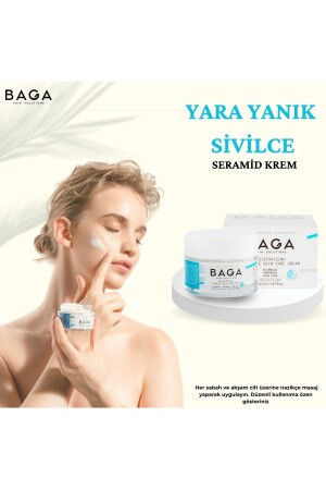 Wound Burn Acne Ceramide Cream - Baga